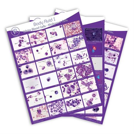 Body Fluid Pathology Reference Poster Body Fluid III: Micro-Lining Cel ...