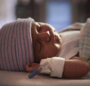 Vyaire T-piece Resuscitation Circuits - Neonatal T-Piece Resuscitation Circuit - M1091316VS