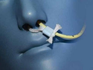 Tube Retention System Avanos Corgrip Nasogastric / Nasointestinal Tube - Corgrip Feeding Tub ...