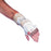 Excel Splinting Material Sheets by Chesapeake Medical
