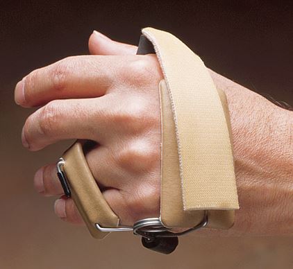 Nerve Orthosis 
