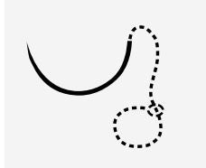 Sutures