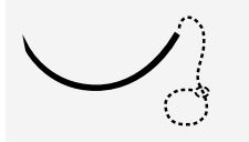 Sutures