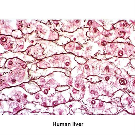 Chandler's Reticulum Stain Kit Pint Kit