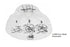 Allied HealthCare Products Flexible Face Shields - Allied Flexible Face Shields - L63002
