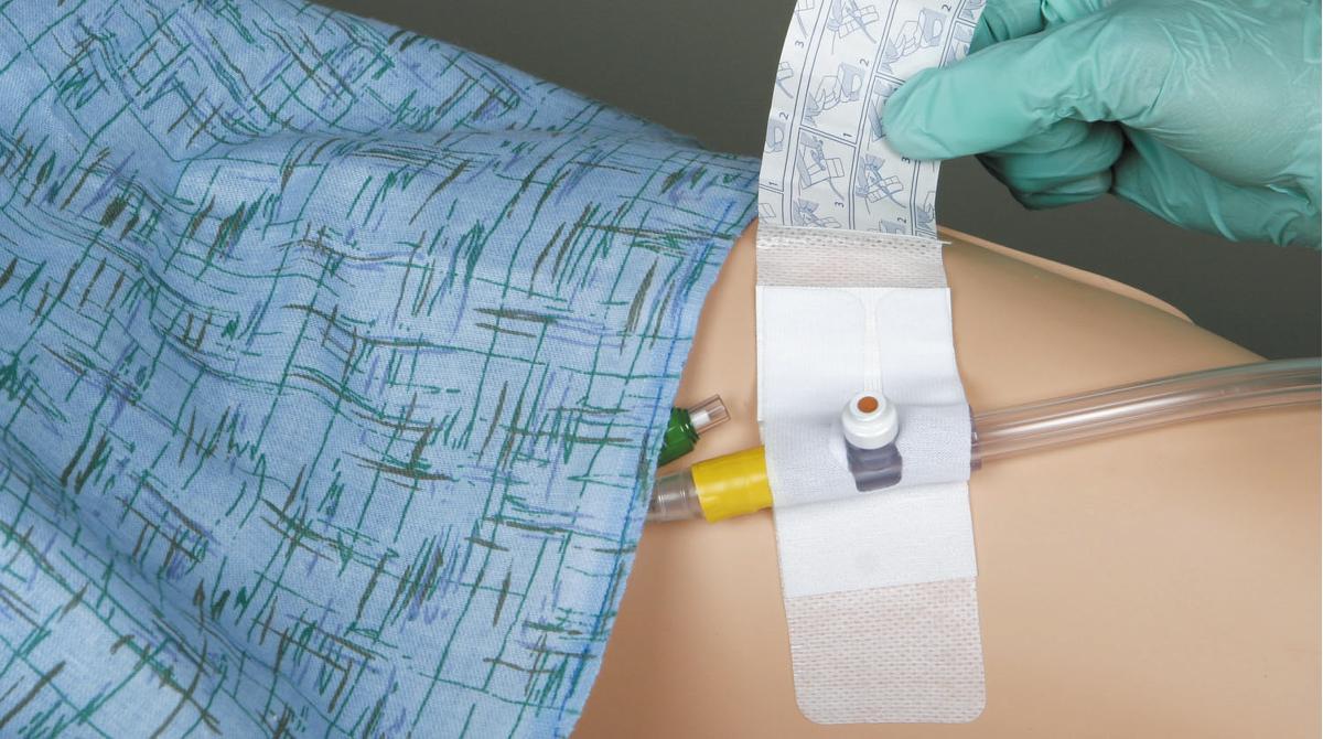 Foley Securing Device Adhesive Foley Securement Device — Grayline Medical