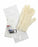 Medline Intermittent Catheterization Tray - Intermittent Catheterization Kits with PVP Pad, No Catheter - DYNDINSERTKIT