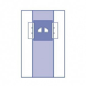 Medline Sterile Special Procedure Surgical Drape - Tunneled Catheter / Port Insertion Drapes, 83" x 145" (211 cm x 318 cm) - DYNJP4131
