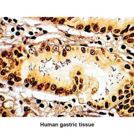 Verhoeff Elastic Stain Set Elastic Fiber Control Slides