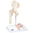 Femoral Fracture and Hip Osteoarthritis