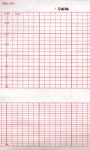 Graphic Controls Medical Chart Recording Papers - Corometrics Fetal Monitor Recording Paper, 140 mm x 130' - 7G30589132