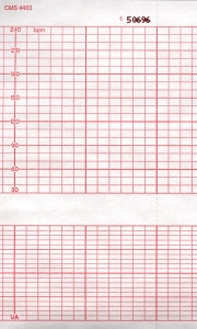 Graphic Controls Medical Chart Recording Papers - Corometrics Fetal Monitor Recording Paper, 140 mm x 130' - 7G30589132