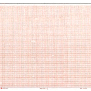 Graphic Controls Medical Chart Recording Papers - Bionet ECG Single-Channel Recording Paper Roll, 25 mm x 80' - 7G32023367