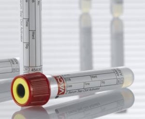 Greiner Bio-One Z Serum Separator Clot Activator - Blood Collection Tube, 13X75, Red and Yellow, 3.5 mL - 454067P