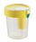 Greiner Bio-One Vacuette Urine CCM Set - VACUETTE Round Urine CCM Tube, Non-Ridged, 9 mL, 16 x 100 Yellow Cap-Black Ring, Conical Base - 455243