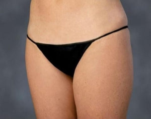 HK Surgical Exam Panties - Disposable Surgical / Exam Panty, Black, Size XL - EP-XL12