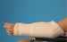 HipSaver Arm-Bow Tubes - ARM-BOW TUBES - L - ABT1300-L