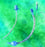 Teleflex Medical Cuffed Endotracheal Tubes - Cuffed Endotracheal Tube, Oral / Nasal, 5.5 mm - 5-12611