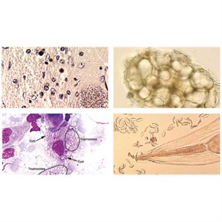 Bacteriology Image Atlas Single-User