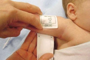 Coviden CRITIKON SOF-CUF Infant Blood Pressure Cuff - Soft-Cuf Disposable Blood Pressure Cuff with 1-Tube Submin Connector, Orange, Infant - 002320