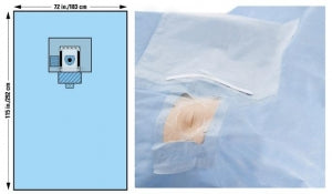 Halyard Health Ophthalmic Drapes - Full Body Opthalmic Drape, Sterile, 72" x 115" - 89356