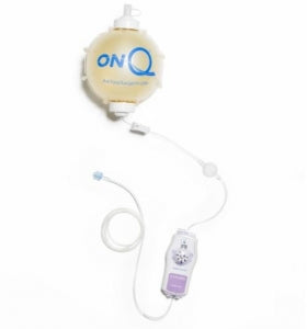 Halyard Health On-Q Pump with Select-A-Flow - On-Q System, 400 mL Fill Volume x 1-7 mL / Hour Select-A-Flow Rate - CB4007