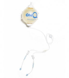 Avanos Medical ON-Q Pump Kits with ON-Q SilverSoaker Catheter - ON-Q Fixed Flow Pump Kit Pain Relief System with SilverSoaker Antimicrobial Catheter, 270 mL, 5 mL / HR, 5" - PM024-A