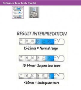 Lombart Instrument Schirmer Tear Test - Schirmer Tear Test - DA0ZZSTT