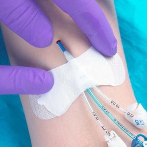 TIDI Universal PICC Catheter Securement - Grip-Lok Medium Wide Adhesive Universal PICC Securement - 3300MWA