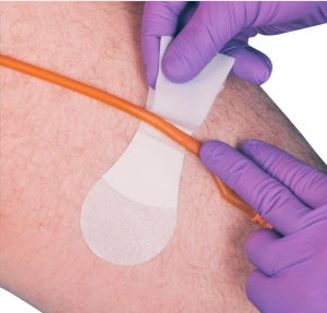 TIDI Large Foley Catheter Securements - Grip-Lok Large Foley Catheter ...