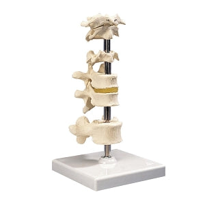 Fabrication Enterprises Inc Six Piece Mounted Vertebrae Model - ANATOMICAL MODEL, VERTEBRAE, REMVBLE STAND - 12-4593