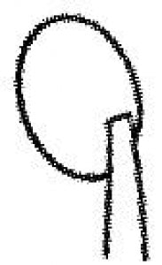 Medline Freer Septum Knife - KNIFE, NASAL, FREER, "D", 15CM, 6" - MDS4637415