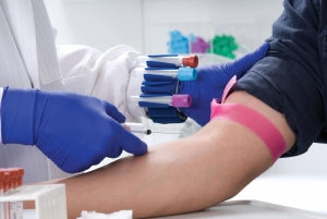 Marketlab Wristband / Holder Set - WRISTBAND / HOLDER, TUBE JOCKEY - 5000