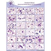 Peripheral Blood Poster Abnormal WBC Morphology Poster