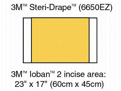 Ioban 2 Antimicrobial Incise Drape by 3M Healthcare