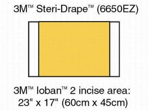 3M Healthcare 3M Ioban 2 Antimicrobial Incise Drape - 3M Ioban 2 Antimicrobial Incise Drape, 23" x 17" - 6650EZ