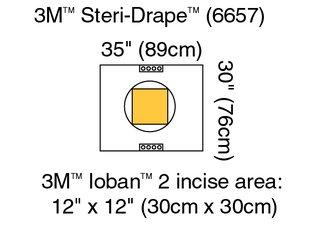 Steri-Drape Pouch 6657 by 3M Healthcare