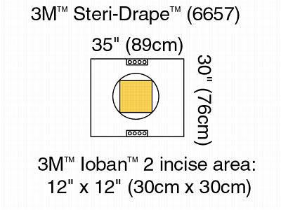 Steri-Drape Pouch 6657 by 3M Healthcare