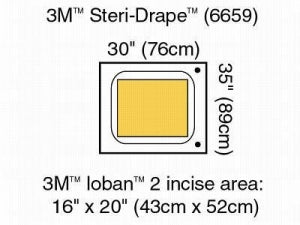 3M Healthcare Steri-Drape Pouches - Steri-Drape Pouch with Ioban 2 Incise Film, X-Large, 16" x 20" - 6659