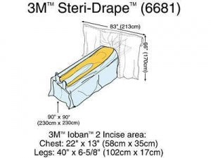 3M Cardio Vascular Steridrapes - Steri-Drape Cardiovascular Sheet with Ioban 2 Incise Film, 100" L x 151" W - 6681