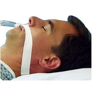 Marpac ET Tape - Endotracheal Adhesive Tape, Cloth, Pediatric / Small - 305B