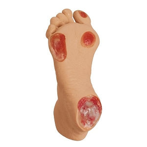 Nasco Life / form Elderly Pressure Ulcer Foot - White - Pressure Ulcer Foot Training Model, Elderly, White - LF00933 U
