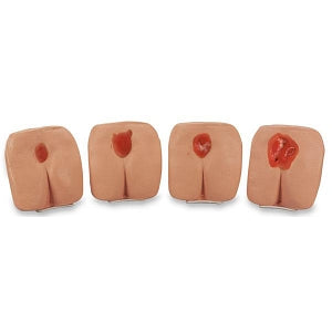 Nasco Life / form Pressure Ulcer / Bedsore Models - Pressure Ulcer / Bedsore Training Model, White - LF00934 U