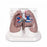 Nasco Lung Cancer Model - Lung Model with Cancer, 4-1/4" x 5-1/2" x 8-1/4" - SB44894G