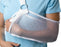 Medline Cool Mesh Arm Slings - Cool Mesh Arm Sling, Size L - ORT11200L