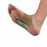 Pedifix Inc Arch Binders with Metatarsal Pad - ARCHBINDER W/METATAR PAD CIRCUM 22-23CM - 600223