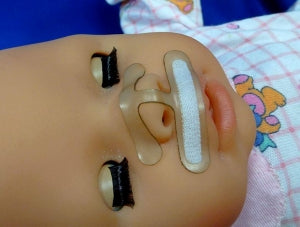 Westmed Septal-H Gentle Cannula Stabilization Devices - Septal-H Cannula Stabilization Device, Pediatric - 5510A
