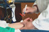 Smiths Medical Blood Sampling Kits - Blood Sampling Kit, Arterial, 22G x 1" - 4044P-1