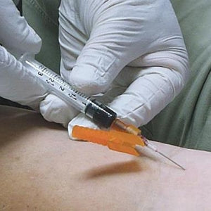 Smiths Medical Blood Draw Hypodermic Needles - Hypodermic Safety Needle, 21 G x 1.5" - 4272