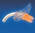 Smiths Medical Portex D. I.C. Tracheostomy Tubes - Portex D. I.C Tracheostomy Tube, Uncuffed, Fenestrated, Size 8.0mm, White - 512080